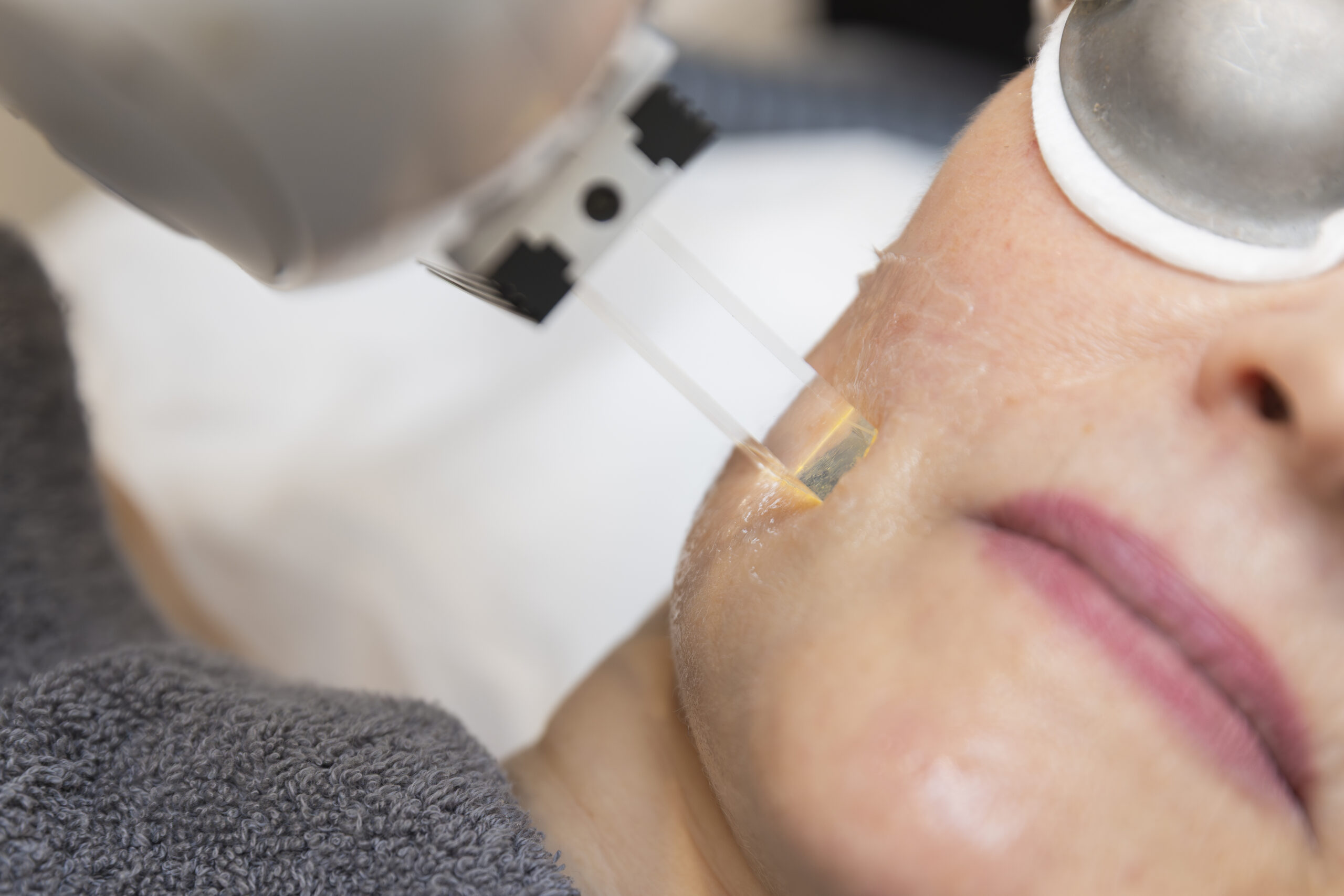 Beauty Oasis Lynton IPL