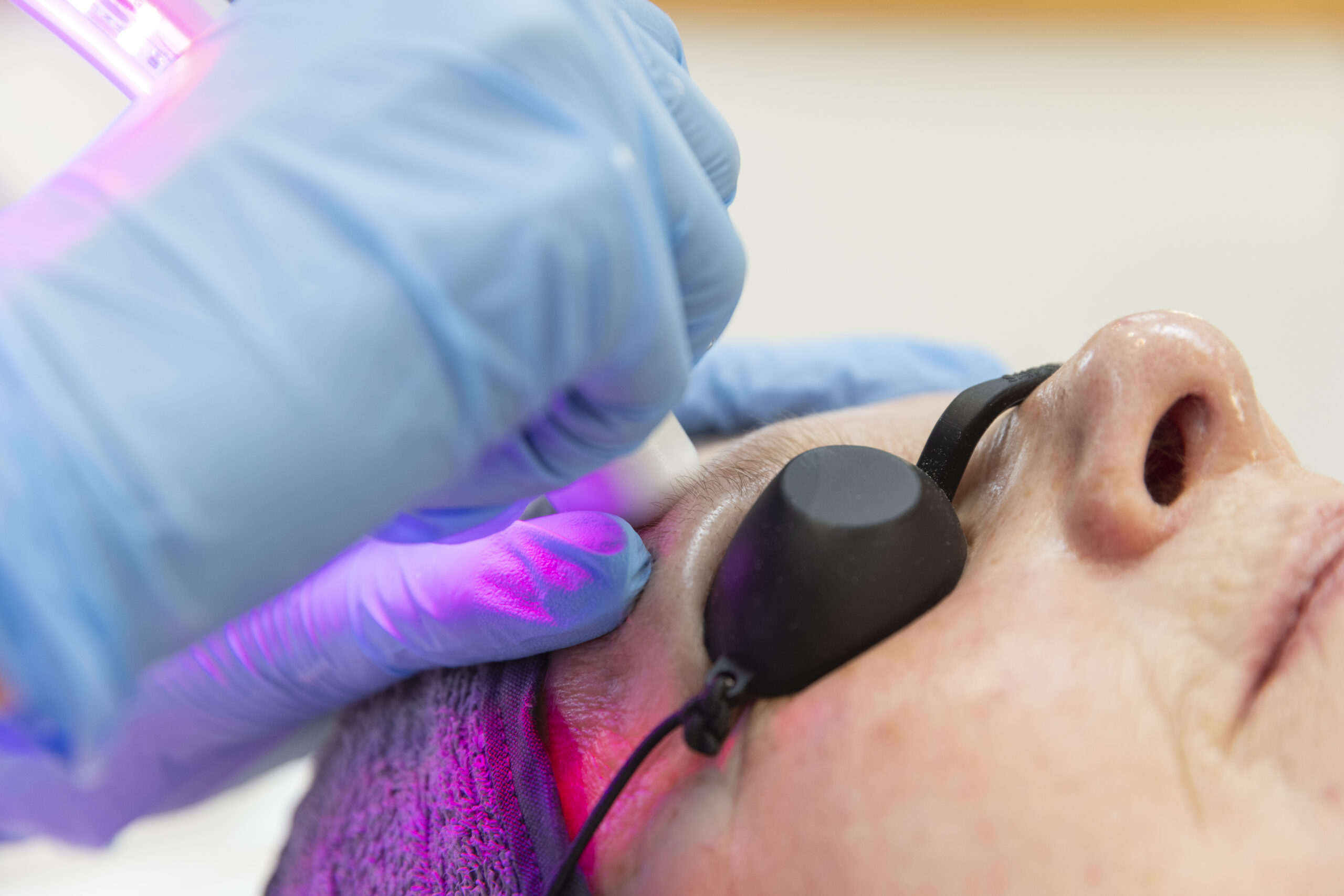 Beauty Oasis Microdermabrasion